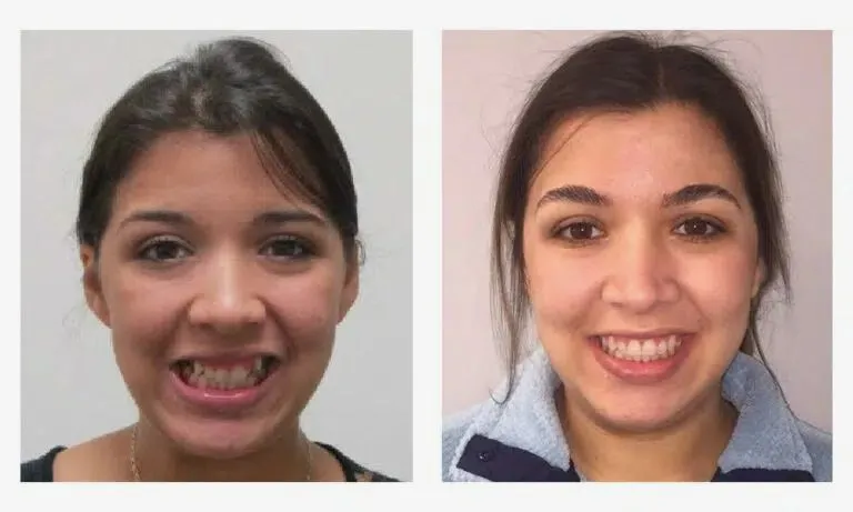 orthodontist chattanooga tn