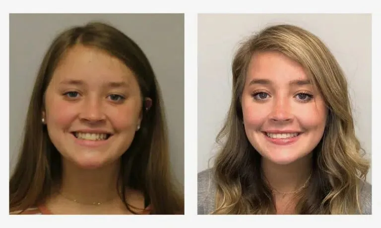 orthodontist chattanooga tn