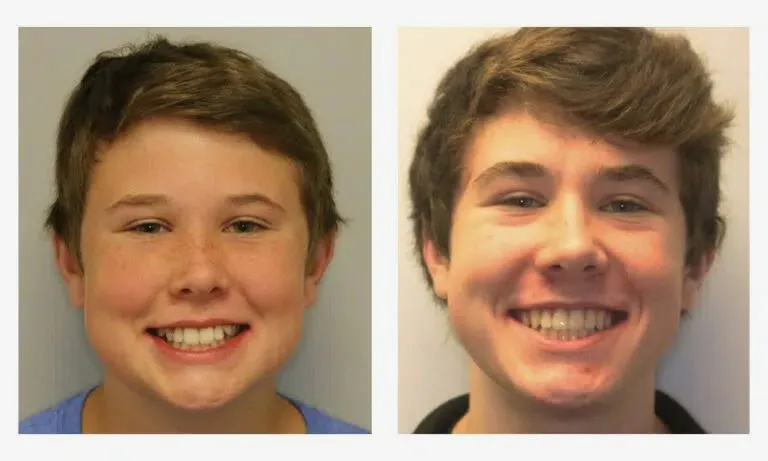 orthodontist chattanooga tn