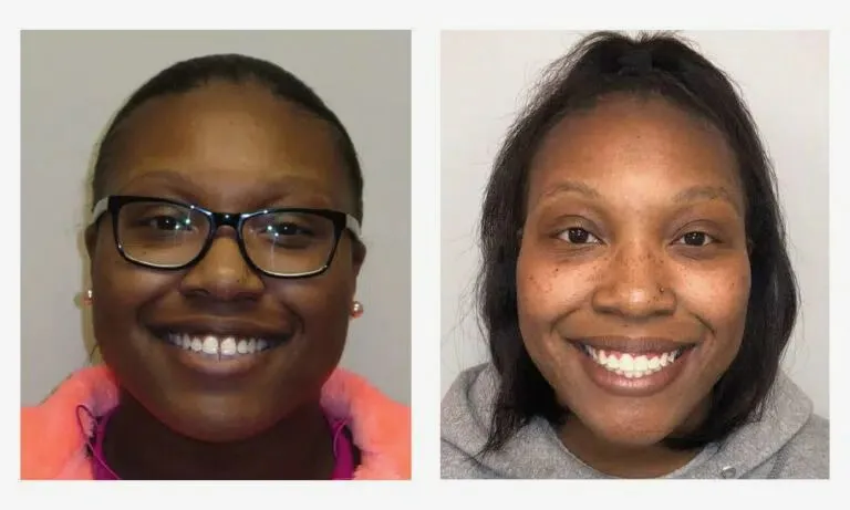 orthodontist chattanooga tn