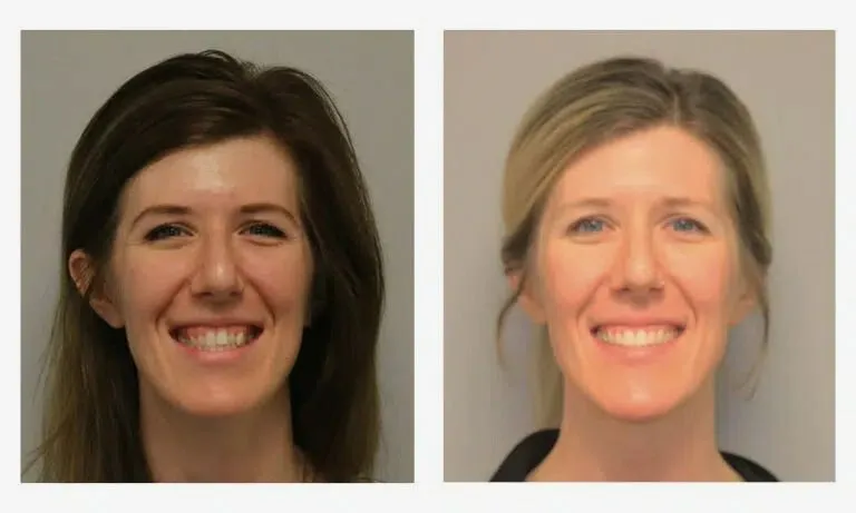 orthodontist chattanooga tn