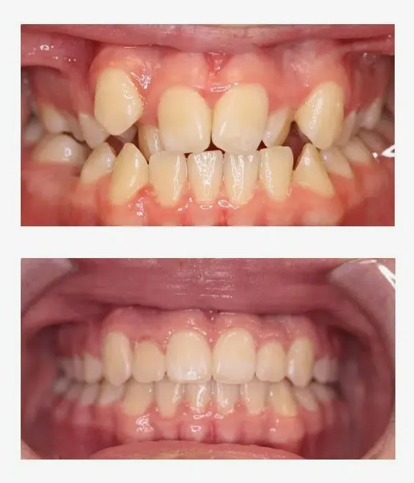 orthodontist chattanooga tn